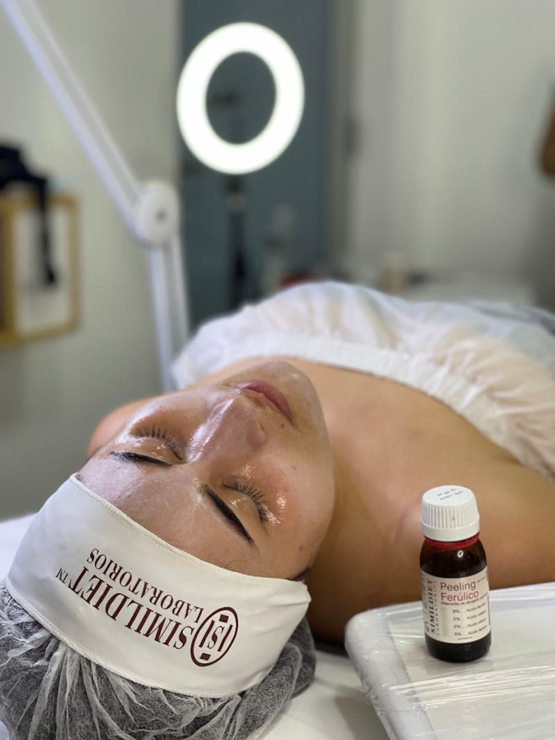 Woman relaxing during facial chemical peel session at spa — recovery timeline and aftercare tips