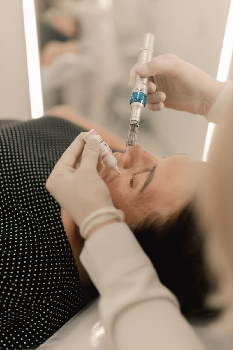 Close-up of microneedling skin treatment being performed at aesthetic clinic — aftercare guide