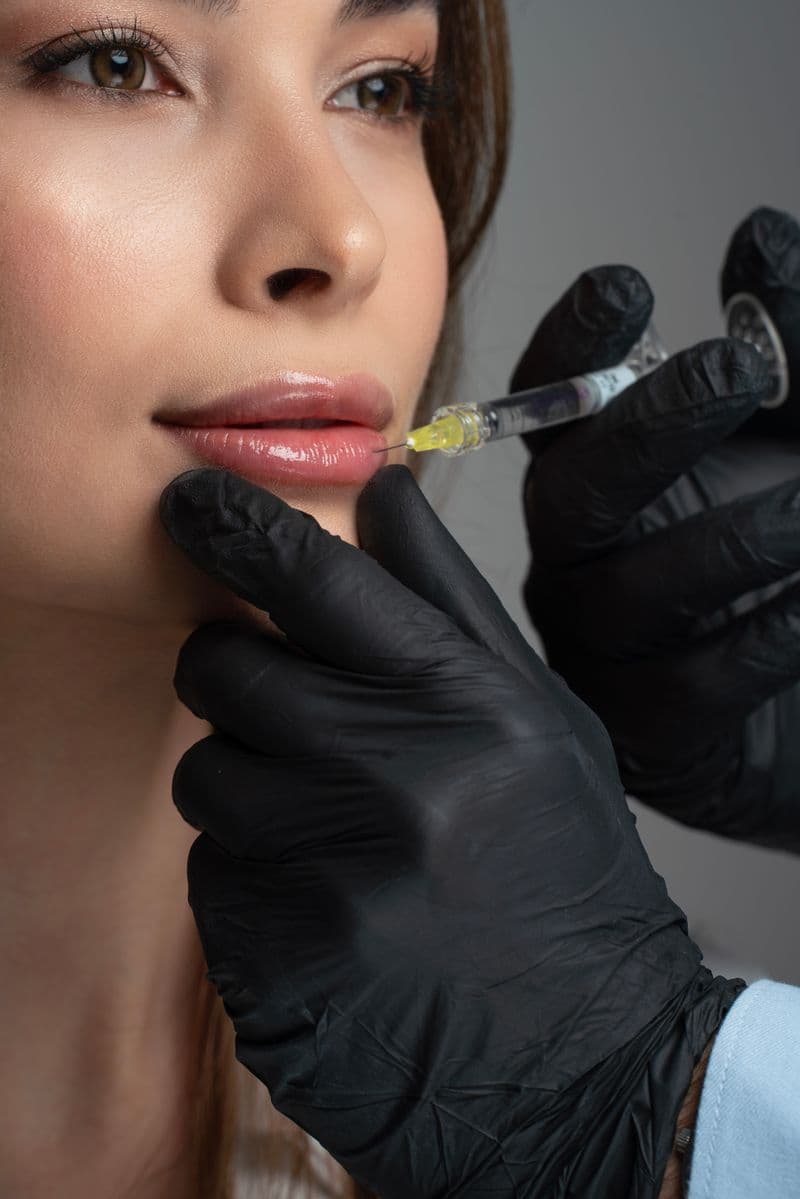 Professional administering lip filler injection — cosmetic lip augmentation aftercare guide