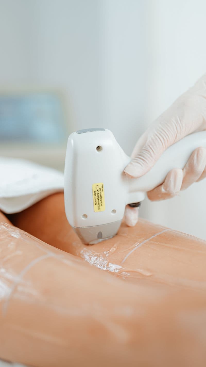 Laser hair removal diode device applied to leg in professional beauty clinic — aftercare tips