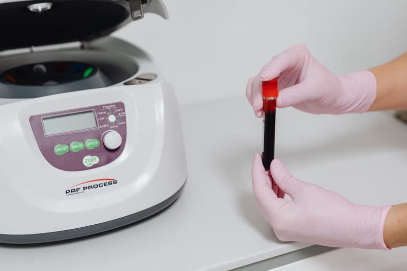Lab technician in gloves handling blood sample tubes for PRP platelet-rich plasma microneedling treatment